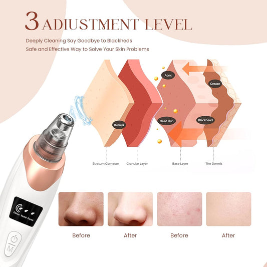 Blackhead Extractor Blackhead Remover with 5 Probes